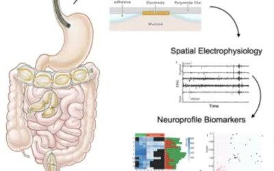 Luminal electrophysiological neuroprofiling system for gastrointestinal neuromuscular diseases